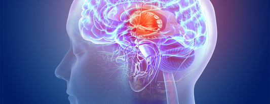 MOST RELIEVING TENSION HEADACHE TREATMENT IN DUBAI